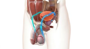 정관수술의 의학적 개념과 정자 이동 경로 차단을 설명하는 3D 일러스트
